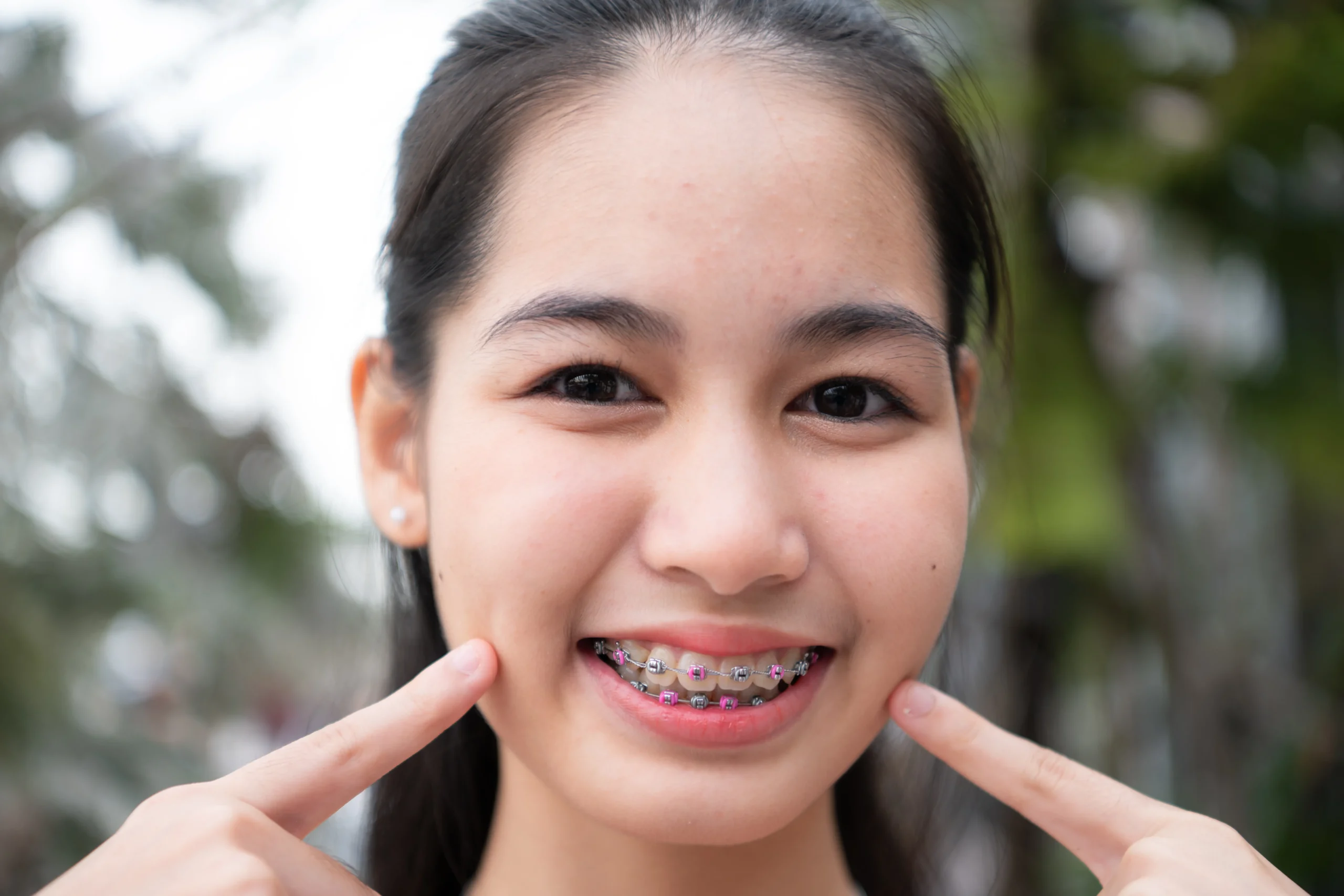 Braces for Adults