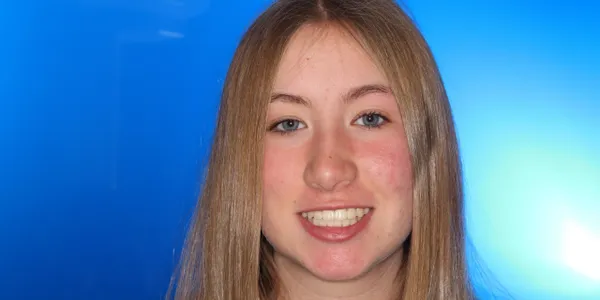 Girl Frontal Smile After