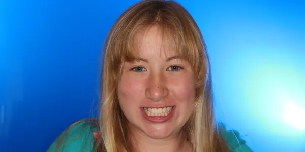 Girl Frontal Smile Before